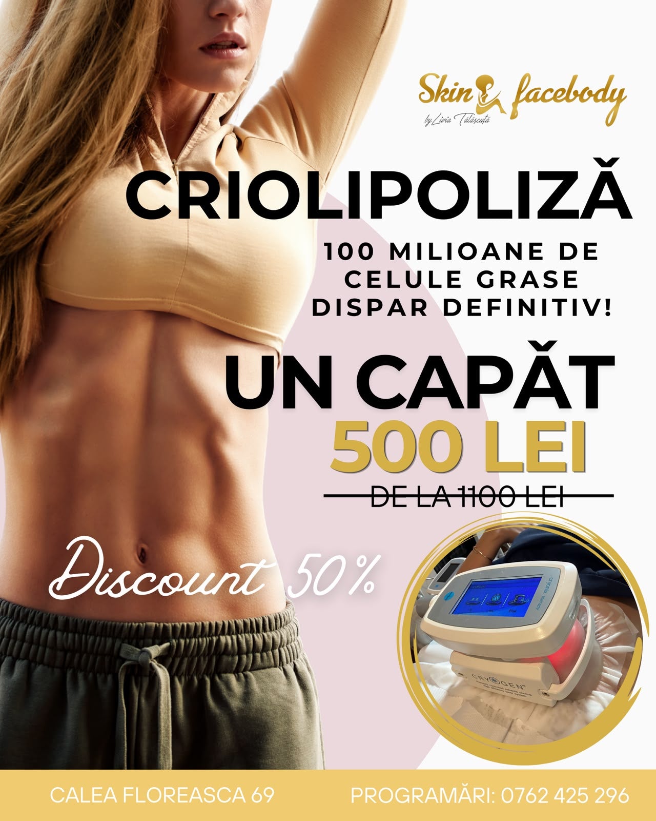 Criolipoliză — Un Capăt