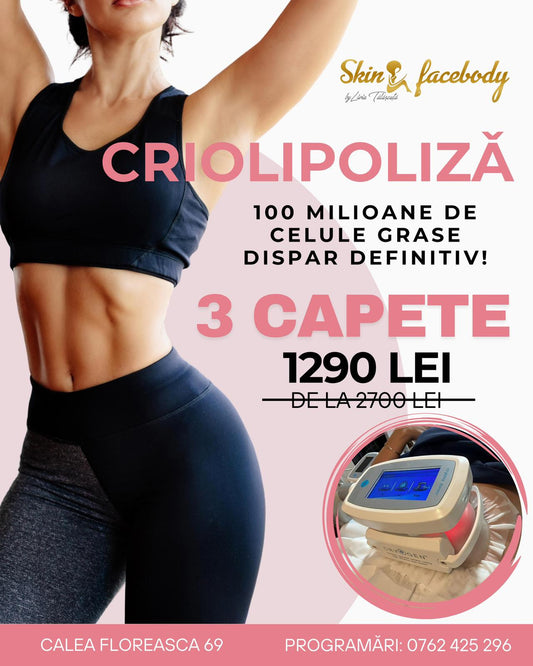 Criolipoliză – 3 capete la preț promoțional